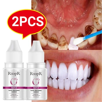 2ks RtopR Bělení Zubů Podstatou Bělení Zubů, Odstranit Plak, Skvrny Ústní Hygieny, Čistící Svěží Dech Zubní Bělicí Nástroje