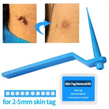 Univerzální Kůže Tag Remover ABS Tamponem Čistící Sada Péče o Pleť Snadné použití Rychlý Účinek Bradavice Léčba Kit